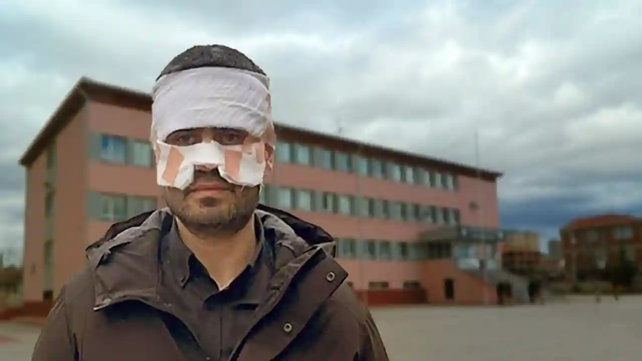 Rehber öğretmen, fizik öğretmenin yüzüne sıcak çay fırlatarak yaktı –